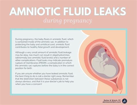 what causes amniotic fluid to leak|Signs Of Leaking Amniotic Fluid Vs. Discharge: The Difference